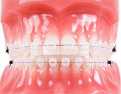 Clarity SL от 3M Unitek