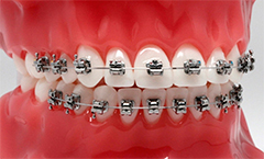 Gemini от 3M Unitek