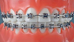 In Ovation L от GAC Dentsply